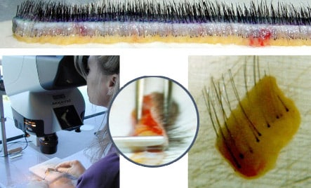 donor strip is cut inot thin slivers with a microscope